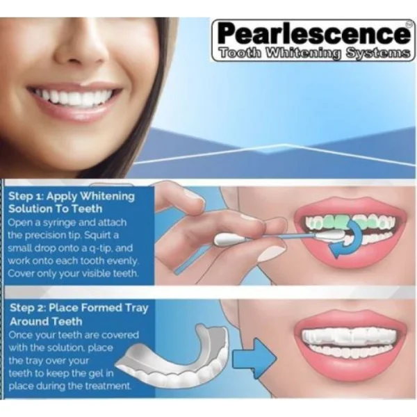 Pearlescence Teeth Whitening System 35% Carbamide Peroxide Gel Kit 4 X 3cc Gels - Image 3